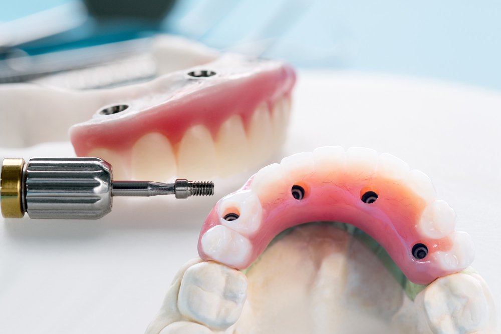 Превосходство зубного лечения и протезирования: путь к здоровой улыбке